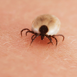 Ticks and Lyme Disease 